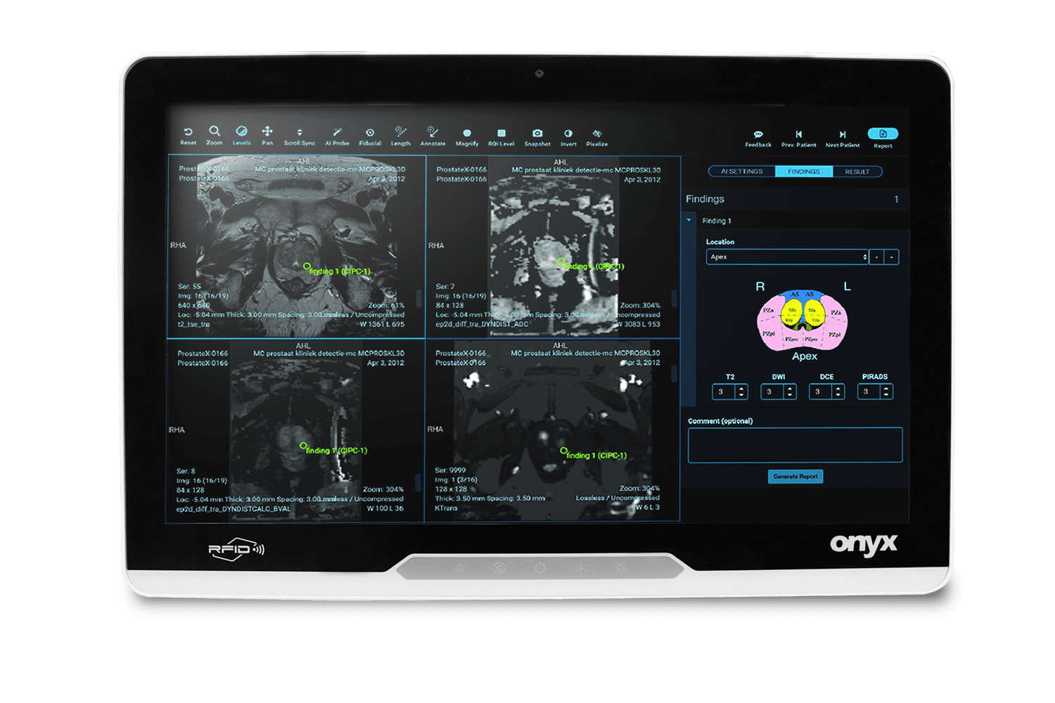 22" Fanless Intel Core Processors Powerful Medical All In One PC