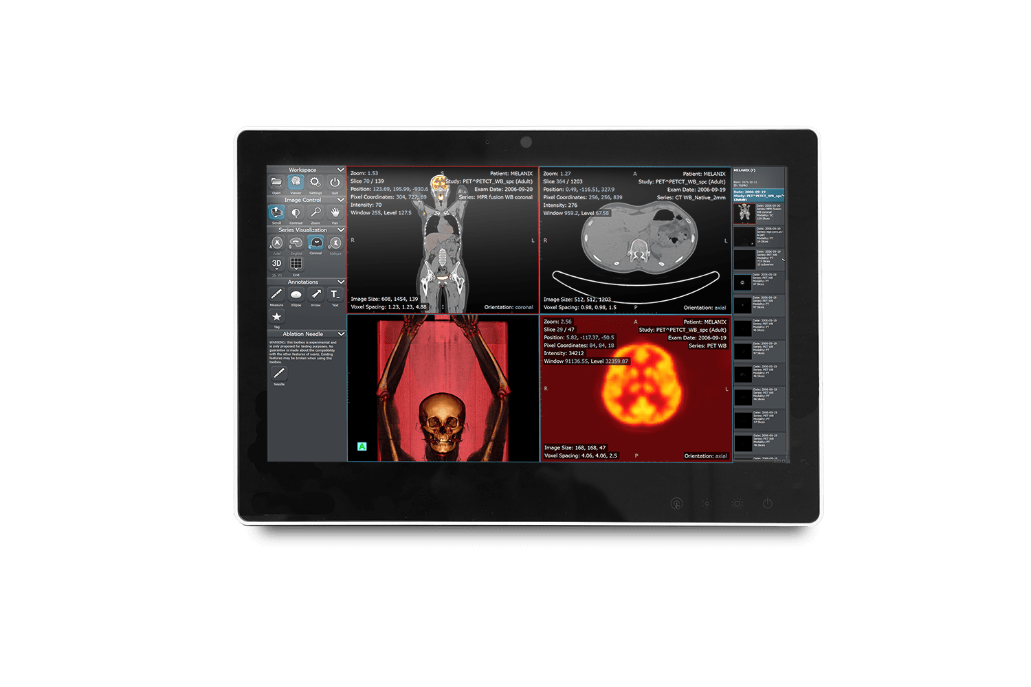 15.6" Fanless Slim Medical All In One PC